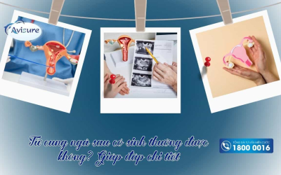 Tử cung ngả sau có sinh thường được không? Giải đáp chi tiết